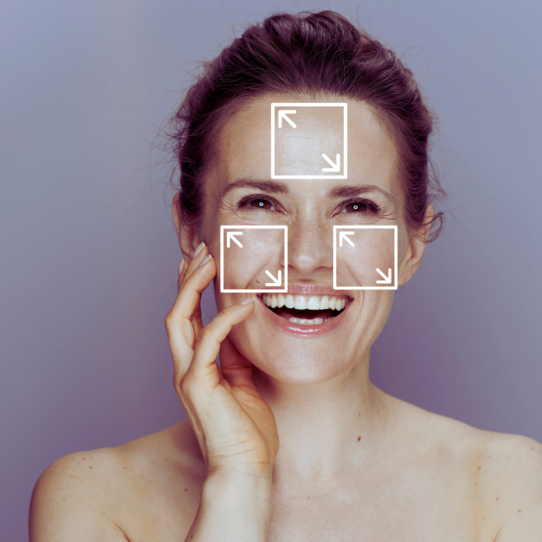 Beauté 100% naturelle grâce au traitement de laser Clarity II. Soins visage de rajeunissement, anti-ride, prévenir le vieillissement. Zone moyenne à traiter sur le visage. 